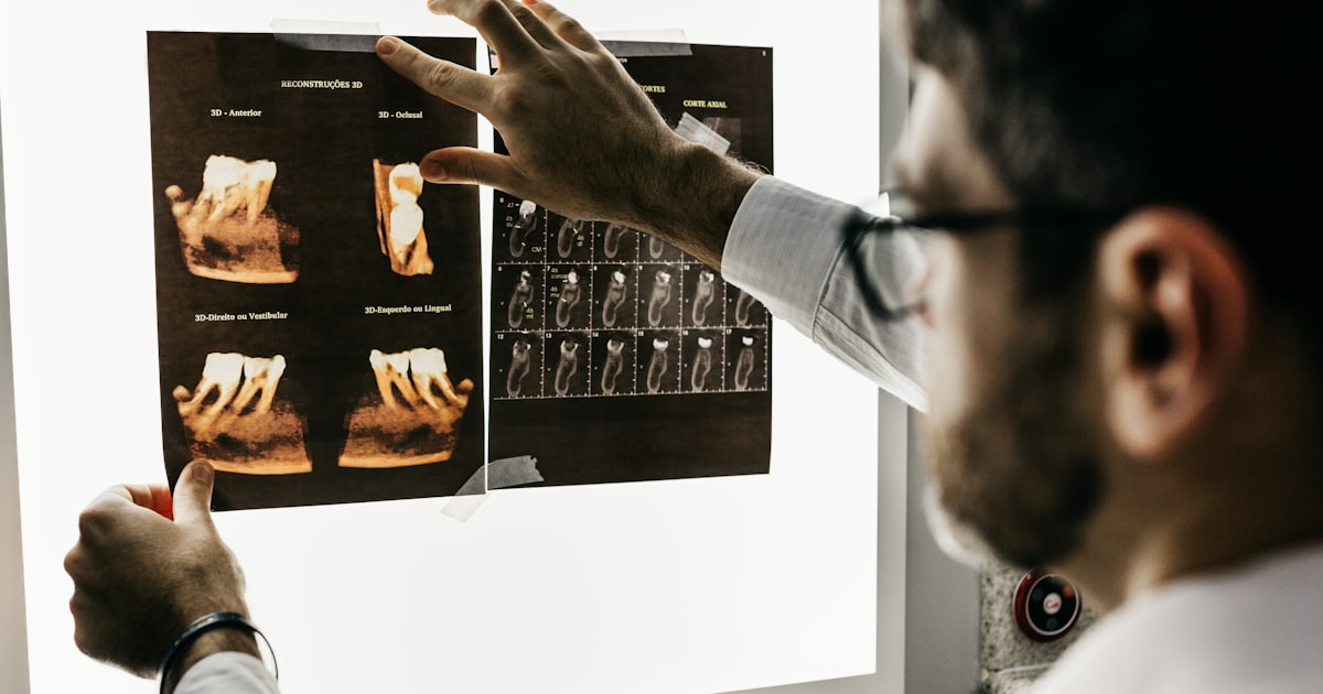 Como Financiar Implante Dentário: Opções e Parcelas